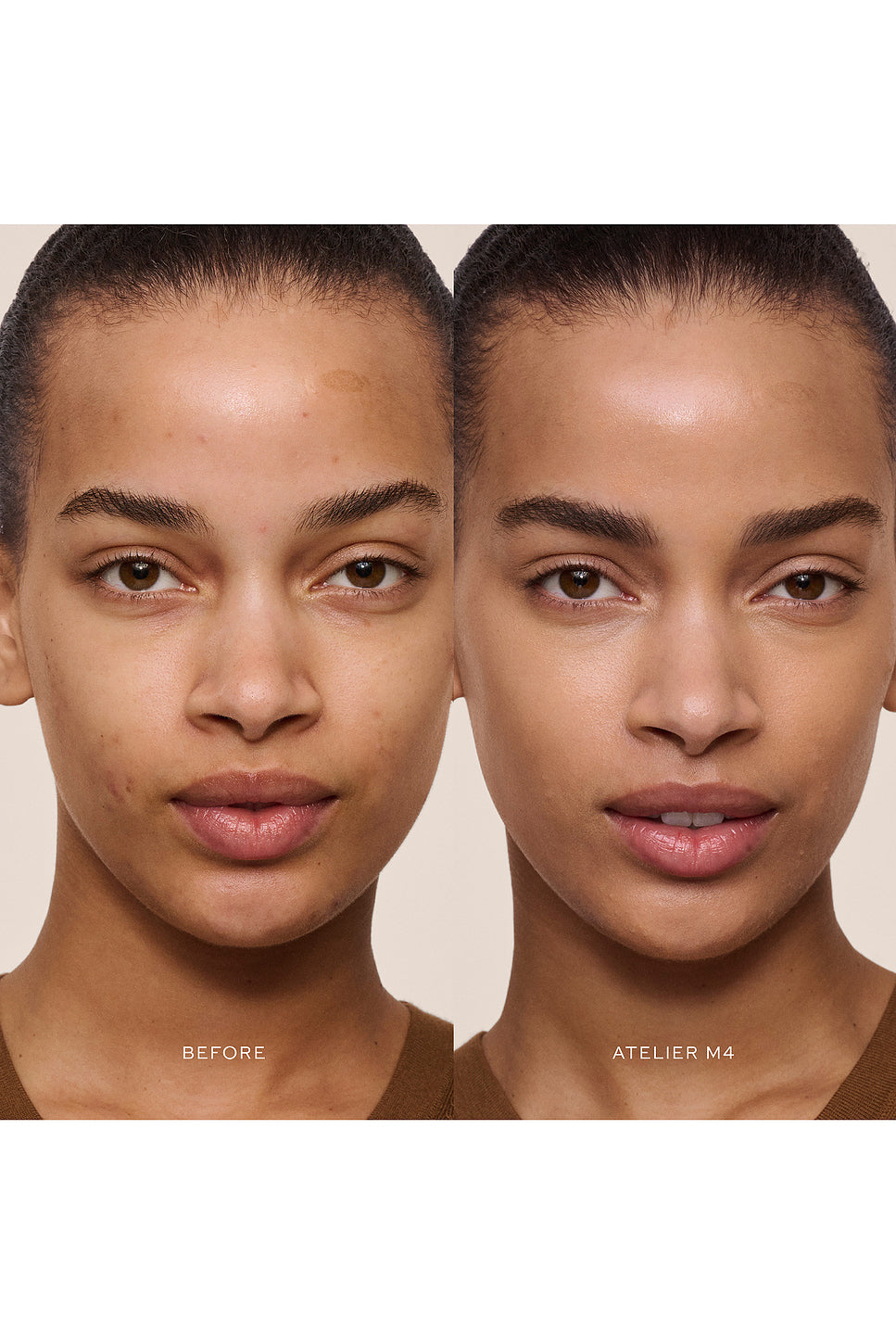 Vital Skincare Concealer