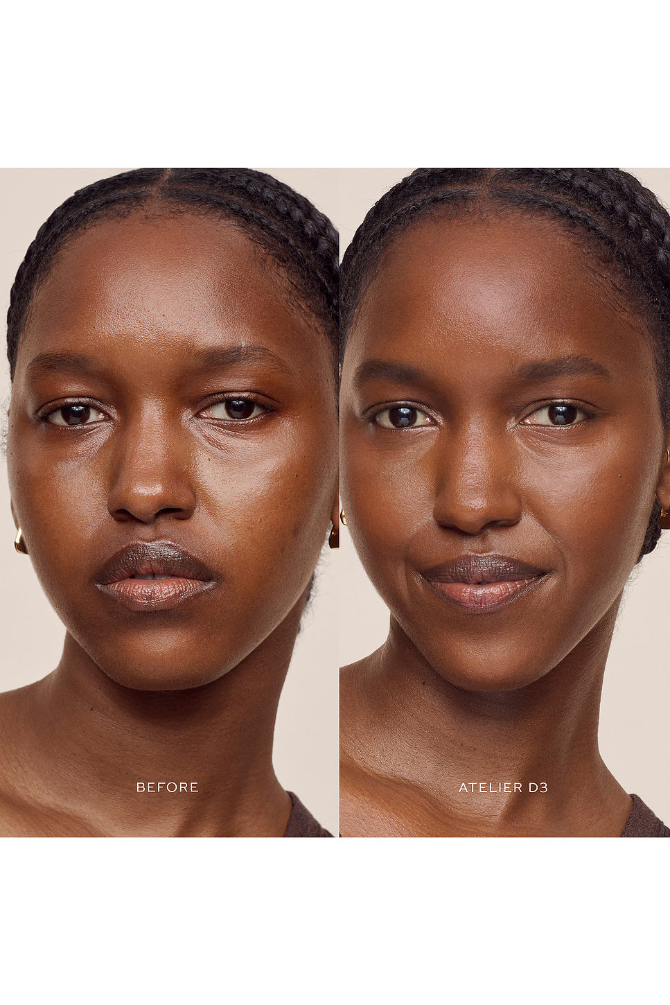 Vital Skincare Concealer