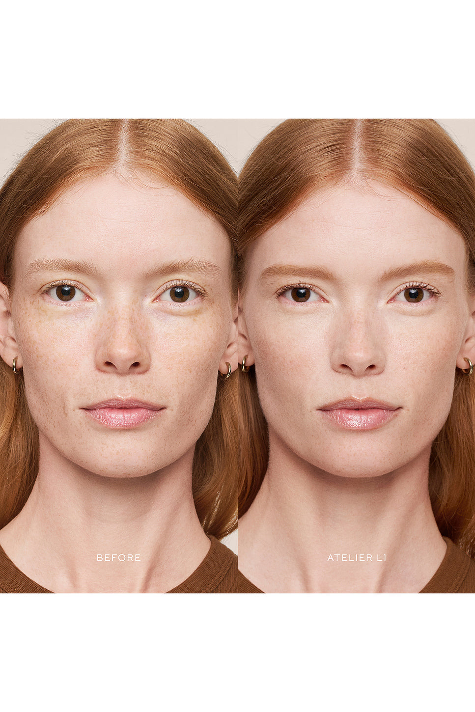 Vital Skincare Concealer