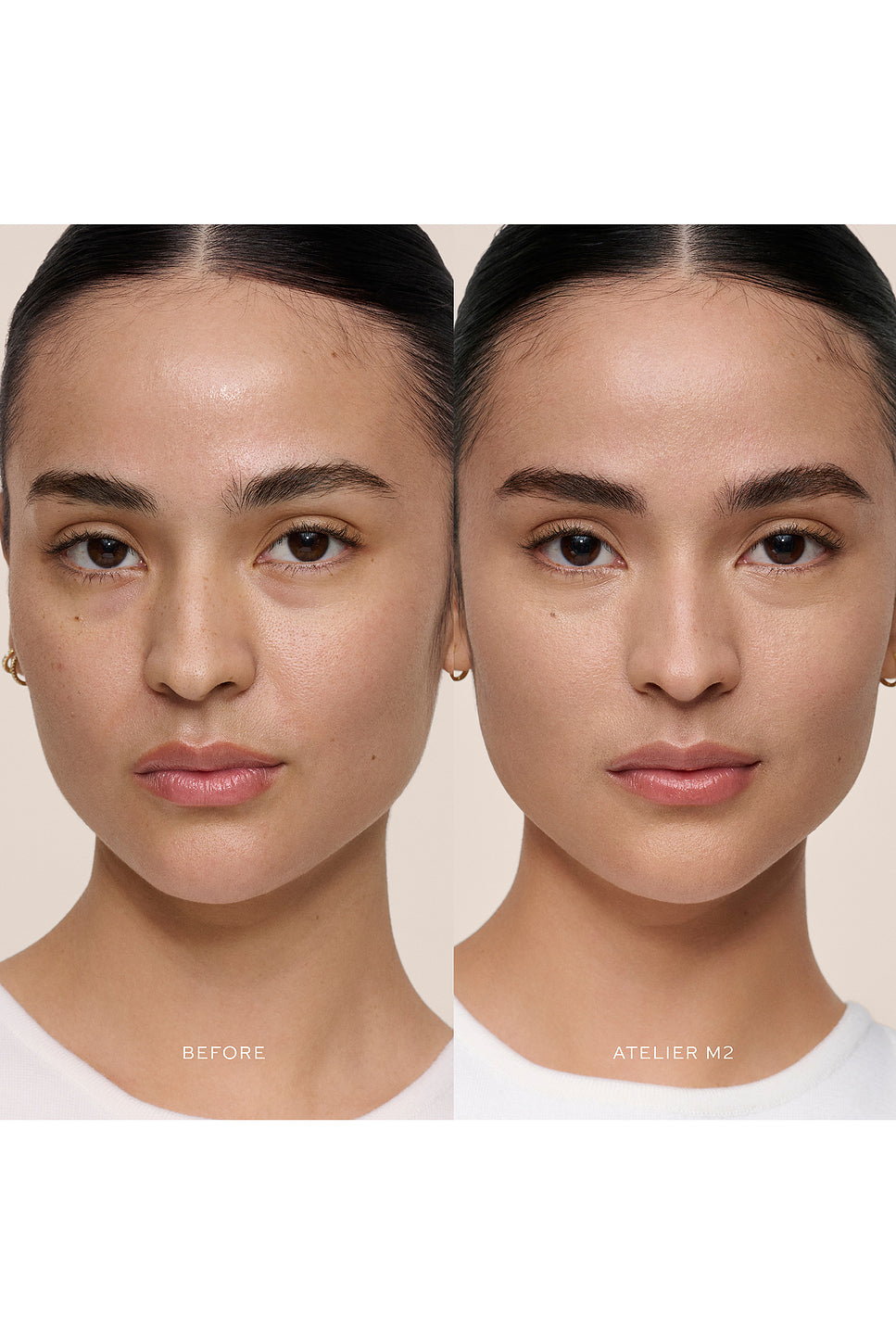 Vital Skincare Concealer