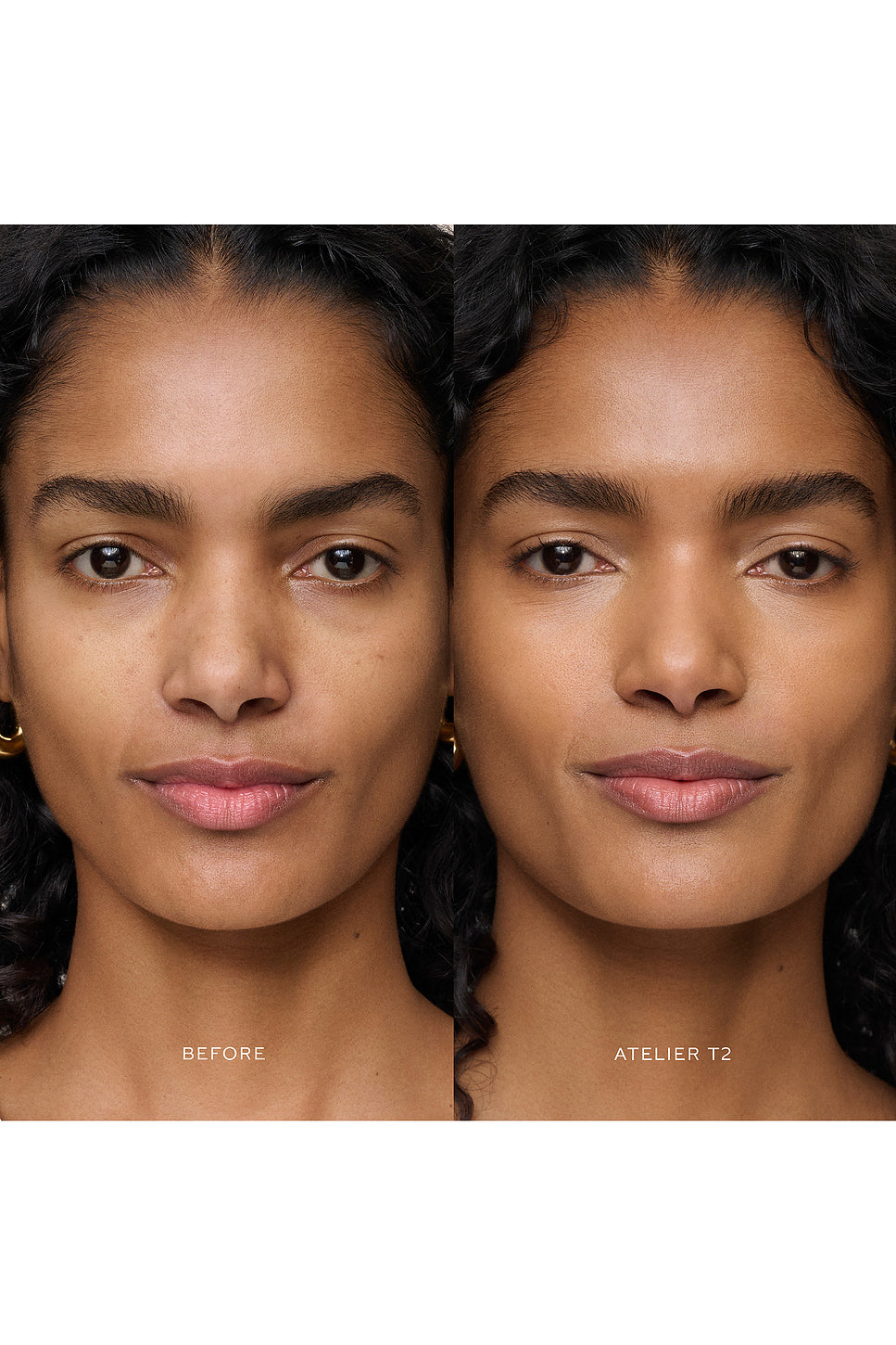 Vital Skincare Concealer