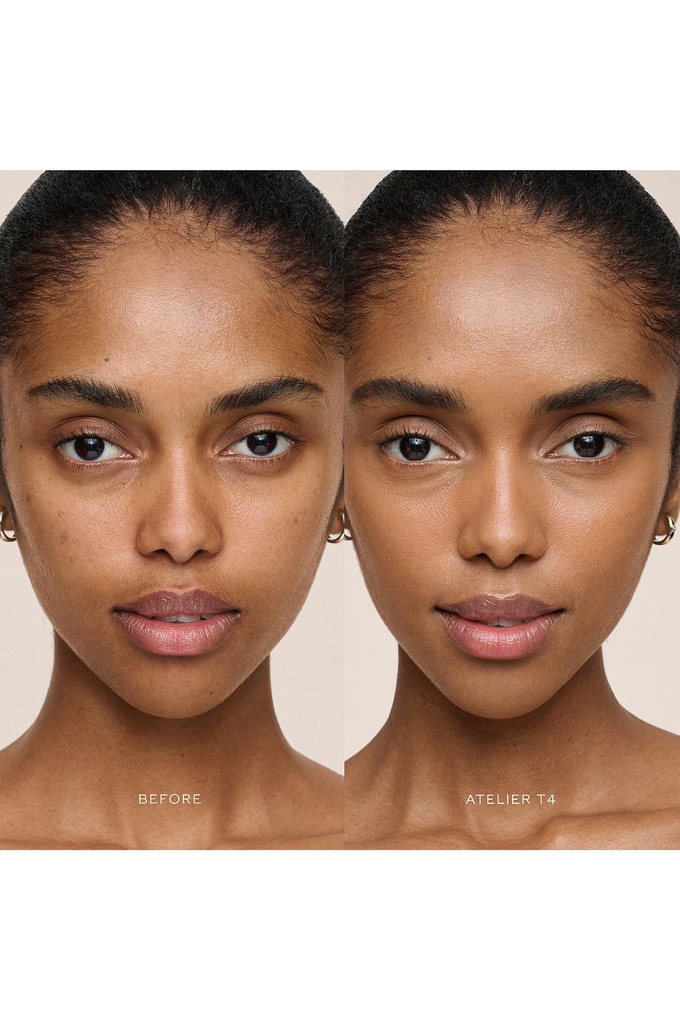 Vital Skincare Concealer