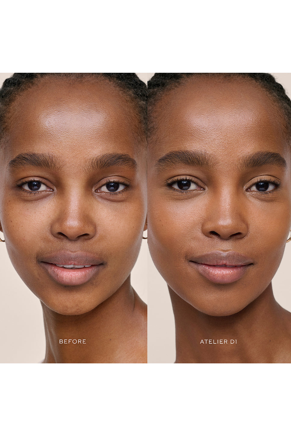 Vital Skincare Concealer