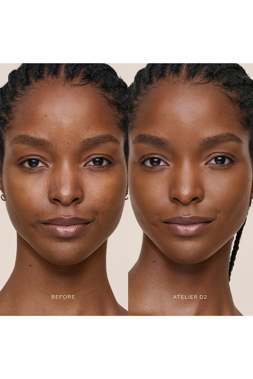 Vital Skincare Concealer