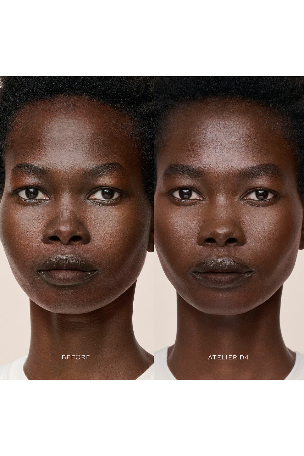 Vital Skincare Concealer