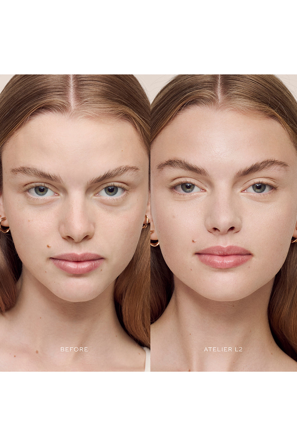 Vital Skincare Concealer